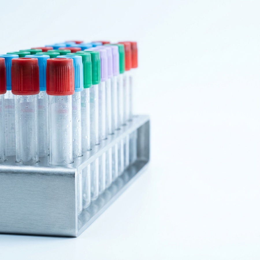 Laboratory specimen tubes in a transport rack